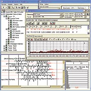 Logiciel informatique "Sylphe" développé spécifiquement pour la datation et les applications en dendrochronologie. Datation par dendrochronologie, synchronisation, synchronisme, chronologies, référentiels, étalons chronologiques, tests statistiques, comparaison, dessin graphique, matrice carrée, corrélation, présentation graphique, indice, calculs, base de données. Création logiciel : Sylvain meignier informaticien, Didier Pousset dendrochronologue (Dendrochronology Consulting), Christine Locatelli dendrochronologue (Dendrochronology Consulting), Le Laboratoire de dendrochronologie de Neuchâtel.